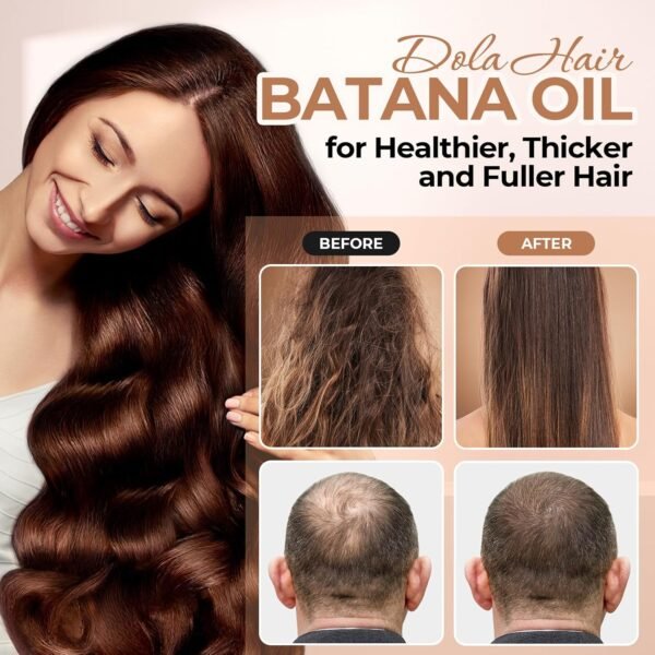 Batana Oil for Hair Growth Organics 100% Natural Pure Batana Hair Oil Batana Oil Nourishes Damaged Hair raw Batana Butter Prevent Hair Loss Natural Hair Growth Oil and Conditioner - Image 6