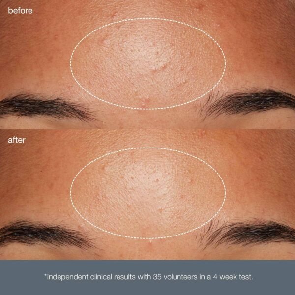 Dermalogica Daily Microfoliant, Face Exfoliator Scrub Powder with Salicylic Acid and Papaya Enzyme, Achieve Brighter, Smoother Skin Daily - Image 8