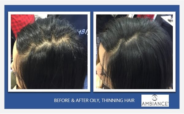 Ambiance Dry Shampoo–3-in-1 Cleans, Covers & Conceals. Absorbs Oil to Refresh Hair, Boosting Body & Shine. Covers Roots & Gray Between Colorings. (Combo- Brush + Refill, Blonde) - Image 4