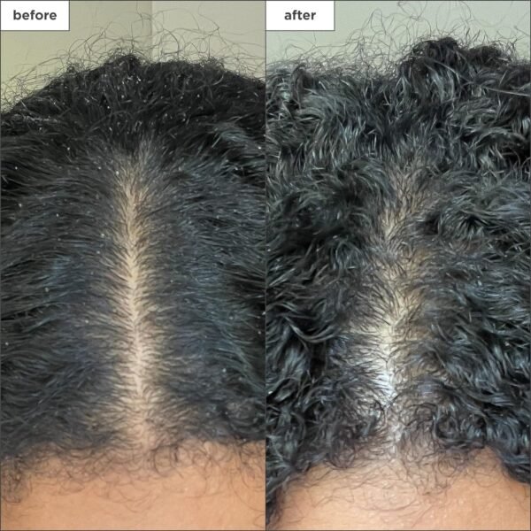 Briogeo Scalp Revival Charcoal + Coconut Oil Micro-Exfoliating Shampoo, Treatment for Dry & Itchy Scalp, Clarifying Shampoo for Build Up, Scalp Scrub for Oily Scalp, Vegan, Cruelty-Free - Image 6