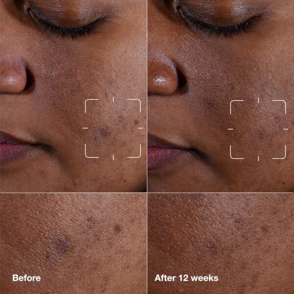 Clinique Even Better Clinical Dark Spot Clearing Serum With Vitamin C | Brightening + Soothing - Image 3