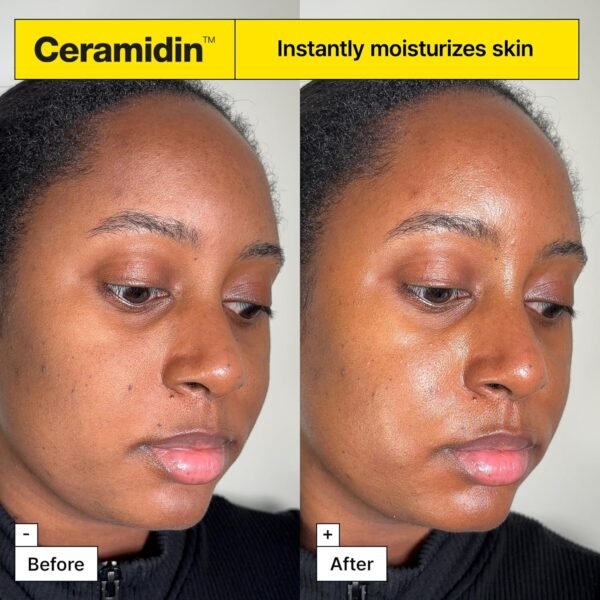 Dr.Jart+ Ceramidin™ Skin Barrier Moisturizer Face Cream For Dry Skin with Ceramides and Panthenol | Korean Skin Care - Image 6